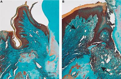 Role of Fibroblast Populations in Periodontal Wound Healing and Tissue Remodeling
